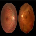 Non Mydriatic Digital Fundus Camera 5 Image Acquisition Modes Multifunctional Software for sale
