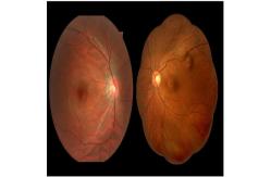 China Non Mydriatic Digital Fundus Camera 5 Image Acquisition Modes Multifunctional Software supplier