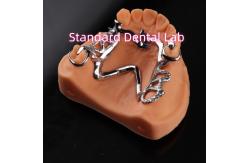 China Cobalt Chrome Framework Ni Be Free removable dental prosthesis China Dental Lab supplier