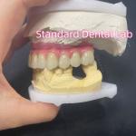 Malo Bridge Hybrid Zirconia All On Four / Six Zirconia Implant Bridge TItanium Bar