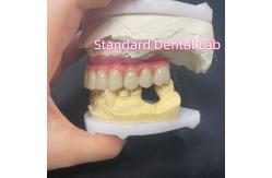 China Malo Bridge Hybrid Zirconia All On Four / Six Zirconia Implant Bridge TItanium Bar supplier