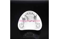 China Printed Scheftner Metal Partial Denture Framework Accurate Customized Cast Partial Denture supplier