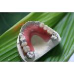 Partial Flexible Invisible Denture For Anterior Teeth for sale