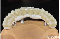 China High Strength Ti-Base Hybrid Zirconia Bridge Fracture Resistance Dental Solution supplier