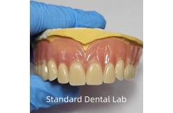 China Standard Ivoclar Complete Acrylic Denture Professional FDA Certified supplier