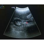 GE 4C-RS Curved Array Abdominal Ultrasound Probe Hospital Instrument for sale