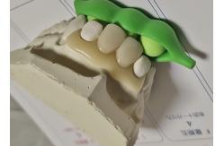 China Resin Metal Free Invisible Denture For Allergic Patient supplier
