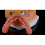 Ivoclar Digital Dental Implant Bar Denture with Attachments Full Acrylic Denture Titanium Implant Supported Dentures for sale
