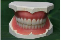 China Immediate Denture ISO13485 Acrylic Partial Denture supplier