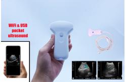 China Visual Convex Array Usb Wifi Ultrasound Probe supplier