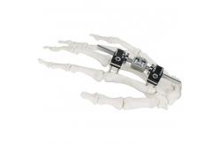 China Orthopedic Surgical Mini Fragment Ilizarov External Fixation Device supplier