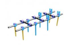 China Orthopedics Spinal Internal Fixation Ⅳ Spinal Fixation System supplier