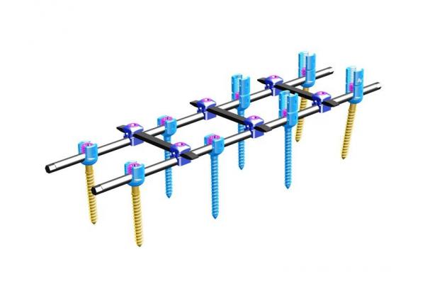 Orthopedics Spinal Internal Fixation Ⅳ Spinal Fixation System