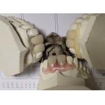 Partial Flexible Invisible Denture For Anterior Teeth