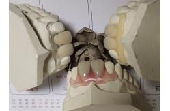 China Partial Flexible Invisible Denture For Anterior Teeth supplier