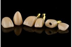 China Titanium Sandblasted Single Tooth Replacement Implant With Gamma Irradiation Sterilization supplier