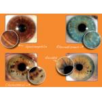 12 MP Iridology Iriscope Iridology Camera