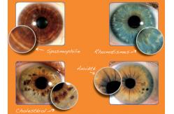 China 12 MP Iridology Iriscope Iridology Camera supplier