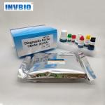 Medical Diagnostics HBcAb Reagent Elisa Test Kit 96 Tests / Pack for sale