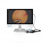 4K UHD Endoscope Camera System With USB Video Recorder 24 Inch Laparoscopic Monitor Surgical LED And Light Source for sale