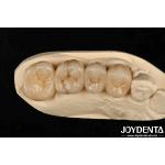 Multilayer Full Zirconia White Style With Layers High Translucency High Resistance To Cracking for sale