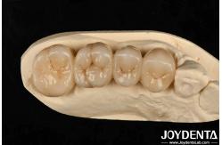 China Multilayer Full Zirconia White Style With Layers High Translucency High Resistance To Cracking supplier