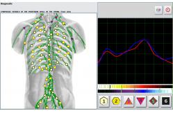 China 4025 Metatron NLS Machine Holistic Practitioners and Naturopathic Biofeedback Device supplier