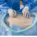 Blue SMMS Disposable Surgical C Section Drape EO Gas Sterile for sale