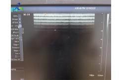 China 13MHz VF13-5 Ultrasound Transducer Probe For Superficial Medical Imaging Device supplier