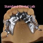 Laser Printing Cobalt Chrome Partial Denture With Clear Clasps for sale