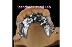 China Laser Printing Cobalt Chrome Partial Denture With Clear Clasps supplier