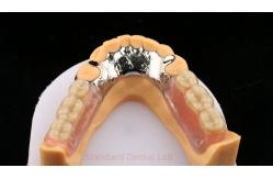 China Metal Alloys Cobalt Chromium Partial Denture Ivoclar Scheftner Comfortable Cast Metal Framewrok supplier