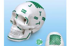 China CE ISO 13485 Maxillofacial Plating System Titanium Bone Implants supplier