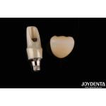 Zirconia Custom Abutments And Bars Dental Restorations For Individual Patient's Anatomy for sale