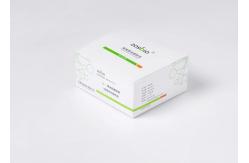 China Laboratory Cardiology D-Dimer Detection Reagent 5min supplier