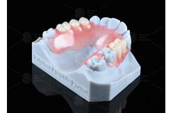 China Natural Looking Valplast Partial Denture Longevity Highly Resistant To Fractures supplier
