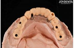 China Yellow Resin Temporary Teeth Smooth Surface Treatment Precise And Stable supplier