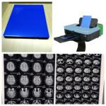 Glossy Inkjet X Ray Film Blue White With 9600x2400dpi Resolution Long Lasting Durability for sale