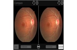 China Intuitive Ultra Wide Field Fundus Camera 35mm Imaging System supplier