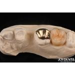 Custom Oral Clinical Wear Resistant Gold Dental Crown With 60K Metallic for sale