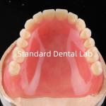 Full Acrylic Denture Acrylic Resin For Dentures Acrylic Complete Denture China Dental Lab for sale