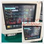 Hospital PHiliph MP5 Patient Monitor Repair 2560×1440 Definition