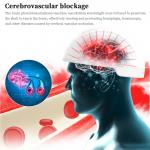 White Color Health Analyzer Machine Photobiomodulation Brain Injury Therapy for sale