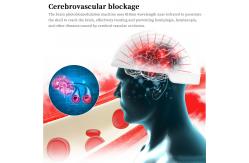 China 810nm Infrared LED Light Photobiomodulation Helmet For Alzheimer's Improving supplier
