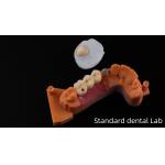 Post Core Dental Lab from China / Metal Post Core with PFM Crown for sale