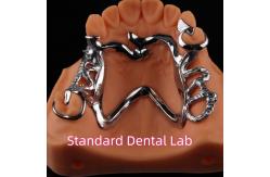China Cobalt Chrome Framework Ni Be Free removable dental prosthesis China Dental Lab supplier