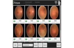 China FDA Digital Retinal Camera Observing Macular Degeneration And Bleeding supplier