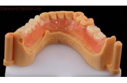 China Dental TCS Valplast Flexible Partial Dentures Dental Lab 3D Print Model High Esthetics supplier