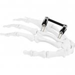 Orthopedic Surgical Mini Fragment Ilizarov External Fixation Device for sale