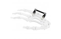 China Orthopedic Surgical Mini Fragment Ilizarov External Fixation Device supplier